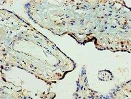 NLRP2 / NALP2 Antibody (aa1-220)