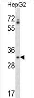 OR4Q3 Antibody (aa278-306)