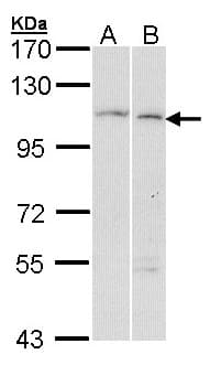 GANAB / Alpha Glucosidase II Antibody (aa654-944)