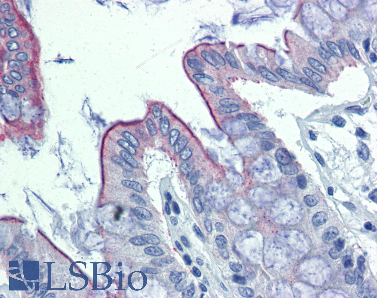 ABHD5 Antibody (C-Terminus)