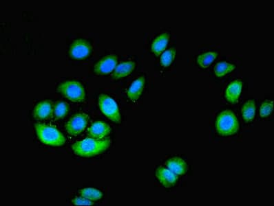 Polyclonal Rabbit anti-Human NT5C1A / CN1A Antibody (IHC, WB)