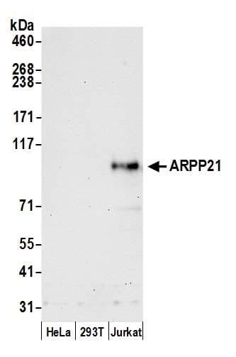 RCS / ARPP-21 Antibody (aa1-50)