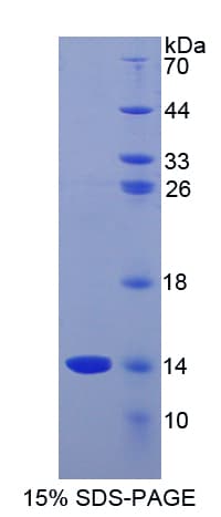 Mouse GNRH Protein (Recombinant His)