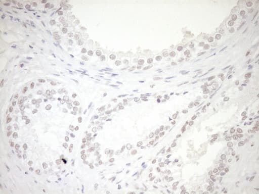 NR1H3 / LXR Alpha Antibody (aa69-329, clone OTI1A5)