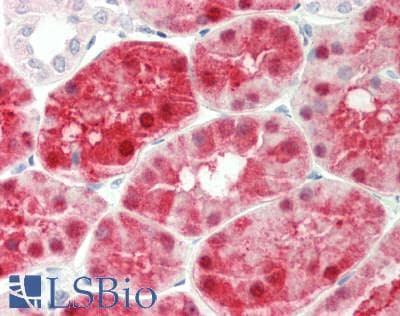 Polyclonal Rabbit anti-Human KHK / Ketohexokinase Antibody (aa71-120, IHC, WB)