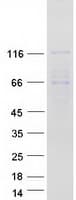 Human PDE3B Protein (Recombinant Myc-DDK (Flag))