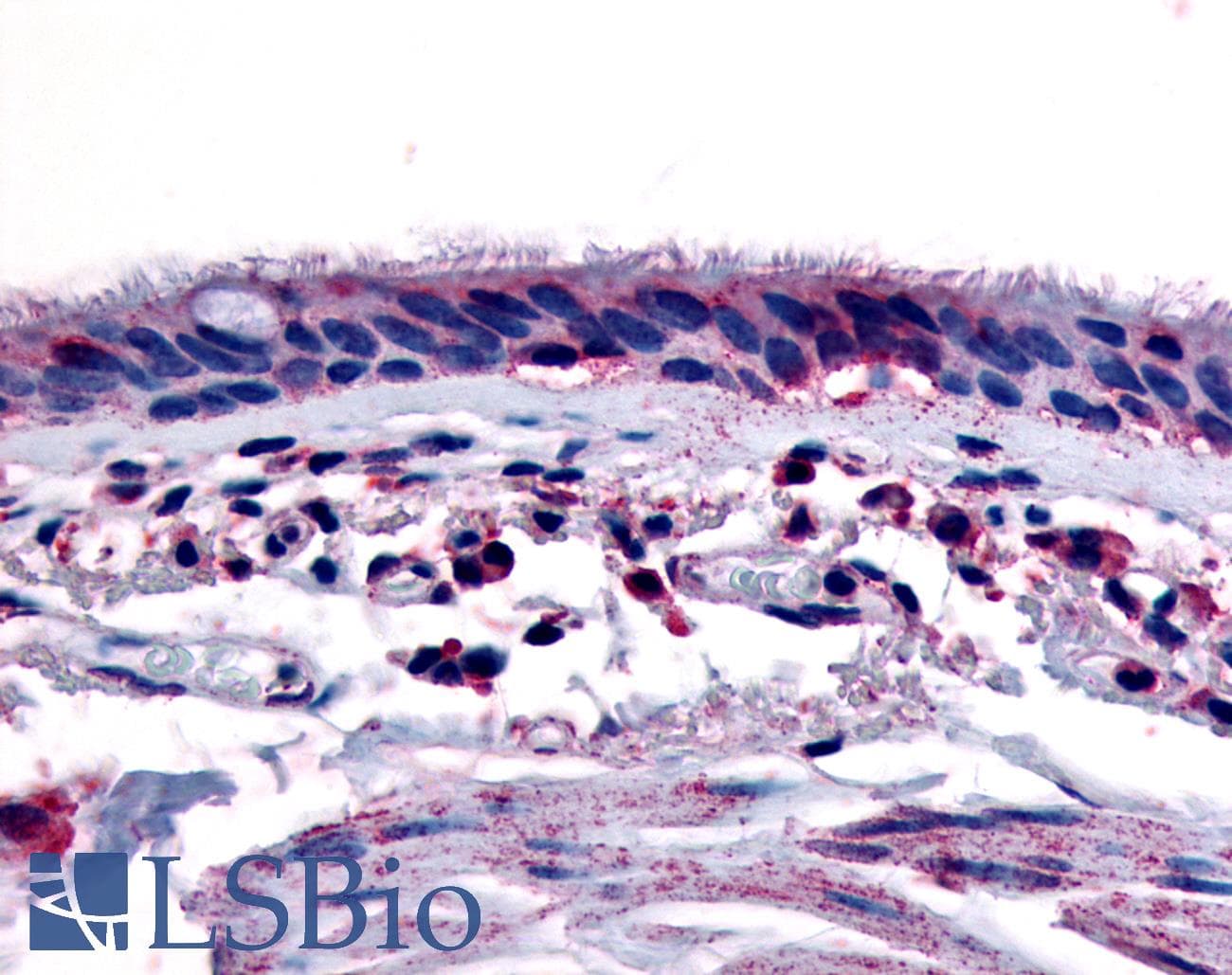 IHC-plus™ Polyclonal Rabbit anti-Human AHR Antibody (Internal, IHC)