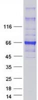 Human HEPACAM Protein (Recombinant Myc-DDK (Flag))