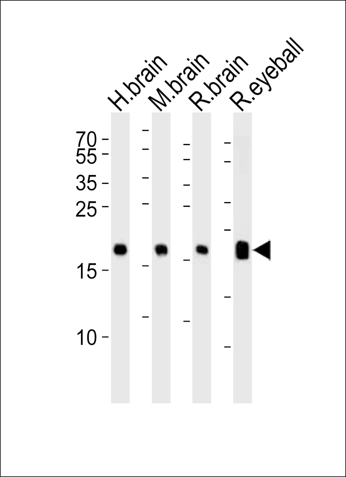 VILIP / VSNL1 Antibody (aa123-150)