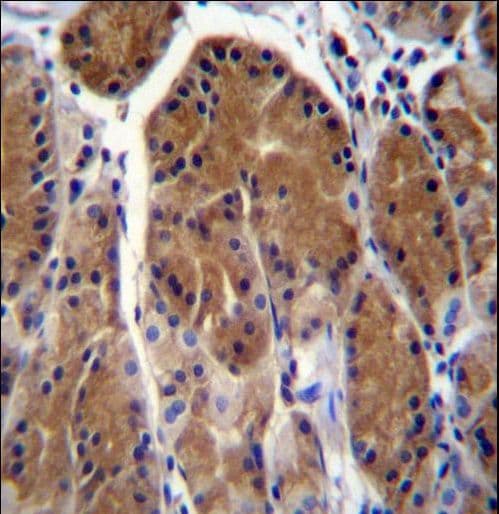 TSSK6 Antibody (aa198-228)