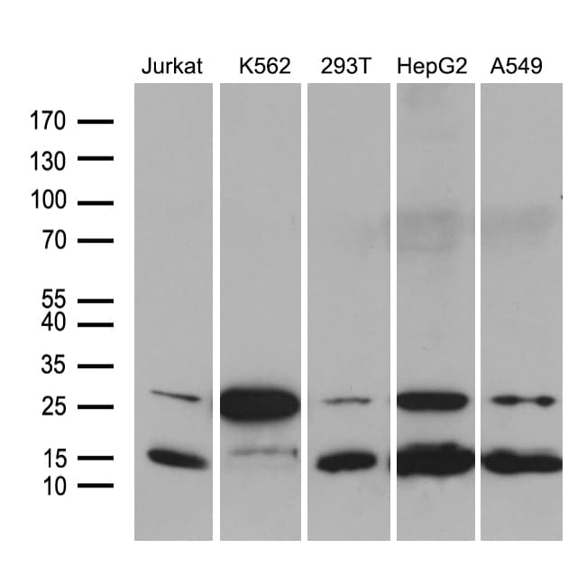 MLC3F / MYL1 Antibody (aa2-150, clone OTI1D9)