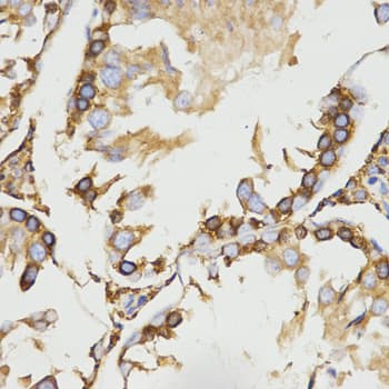 IHC-plus™ LRPAP1 Antibody