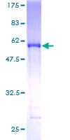 Human SH3BGR Protein (Recombinant GST)