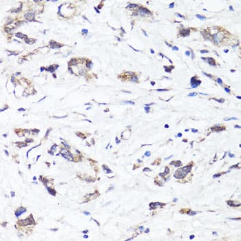 SIRT1 / Sirtuin 1 Antibody