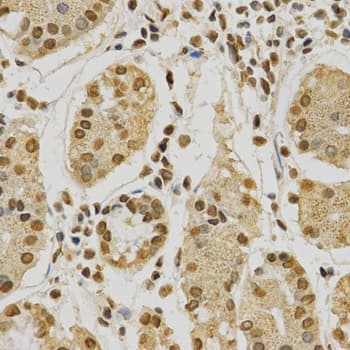 HNRNPA2B1 Antibody