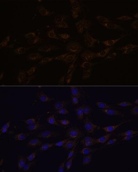 RGS4 Antibody