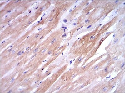 TNNI2 Antibody (clone 2F12A11)