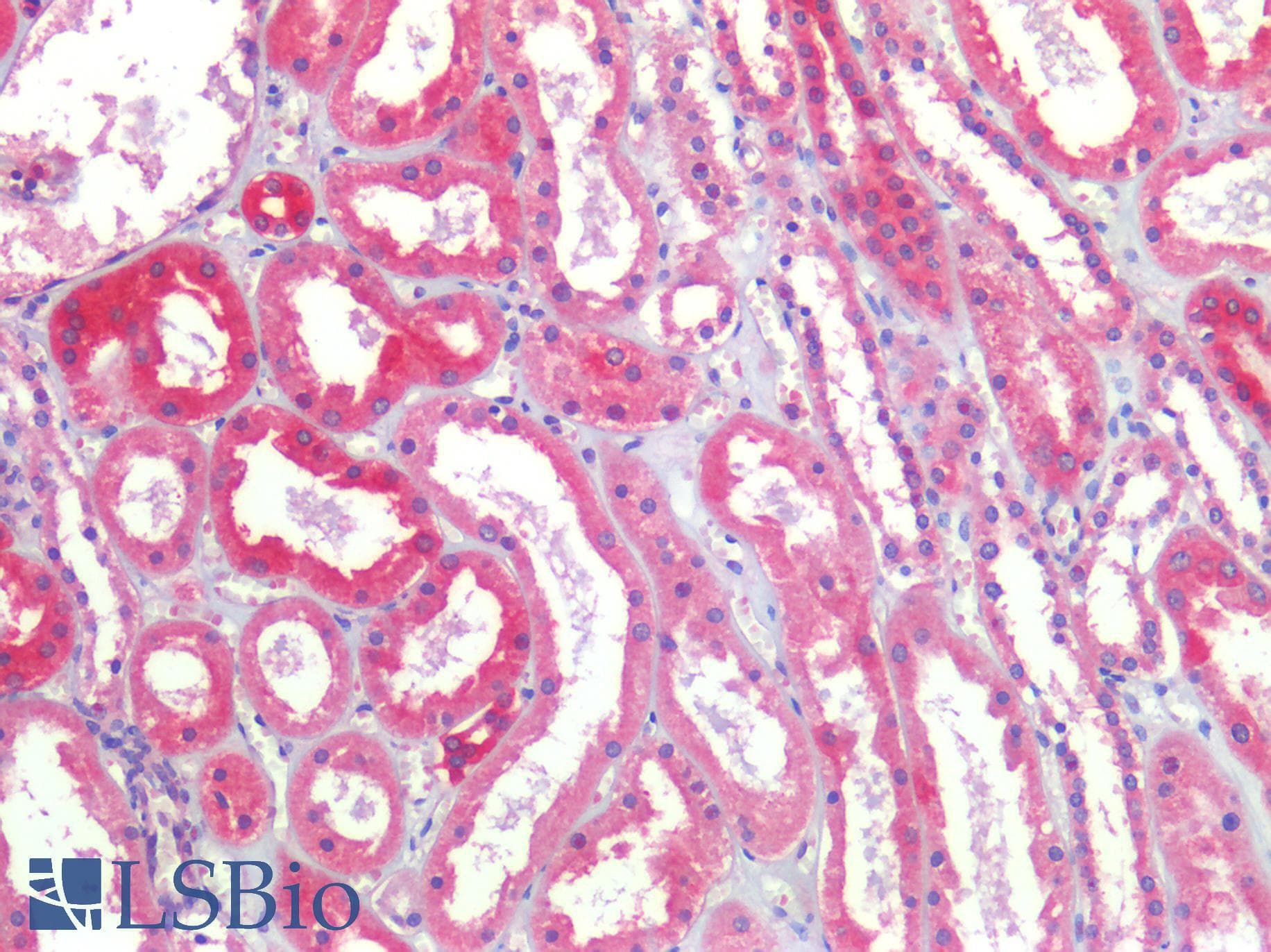 FOLR1 / Folate Receptor Alpha Antibody (aa179-228)