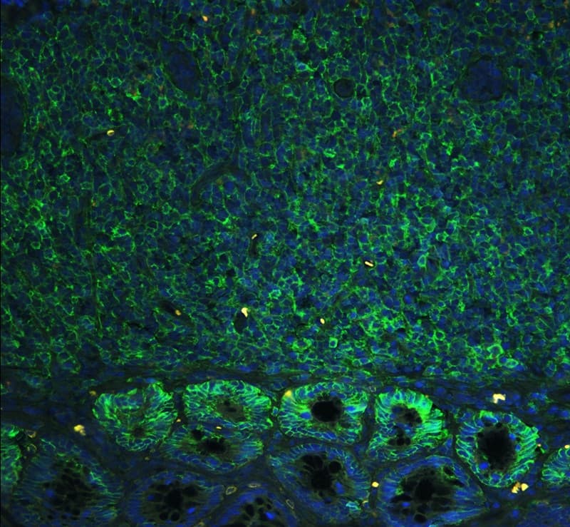 Polyclonal Rabbit anti-Human CD44 Antibody (aa29-56, IHC, WB)