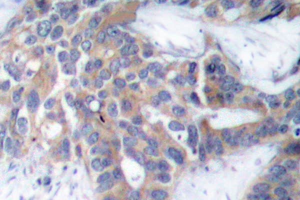 MEK1 + MEK2 Antibody (phospho-Ser218/Ser222)