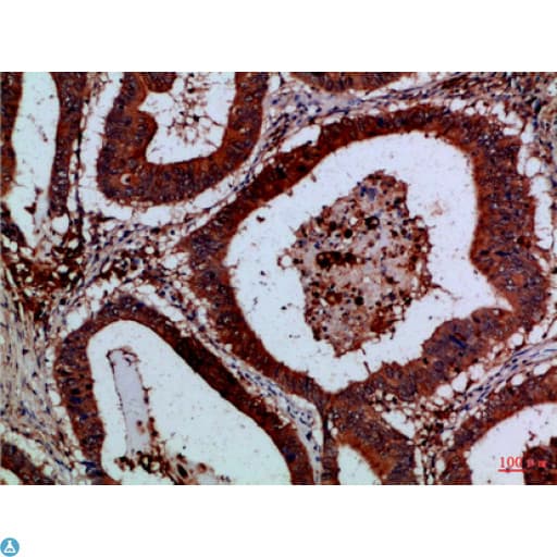 CSTB / Cystatin B / Stefin B Antibody