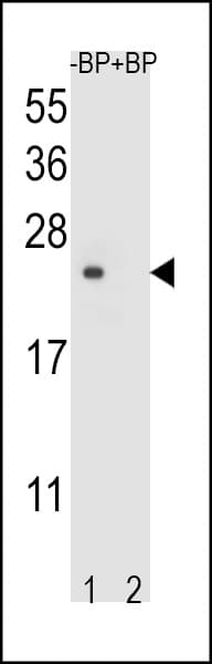TM4SF4 Antibody (aa16-45)