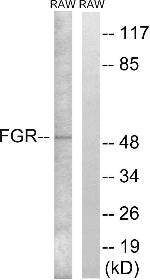 Polyclonal Rabbit anti-Human FGR Antibody (p412, WB)