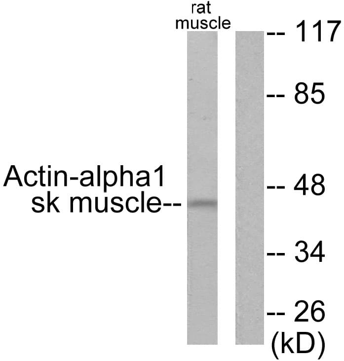 ACTA1 / Skeletal Muscle Actin Antibody (aa1-50)