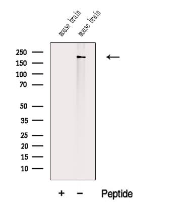 TTN / Titin Antibody
