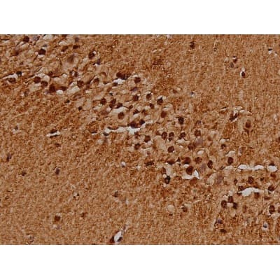MAPT / Tau Antibody (phospho-Ser396)