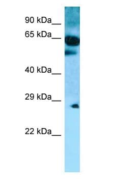Polyclonal Rabbit anti-Human SLC22A9 / OAT7 Antibody (C-Terminus, WB)