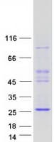 Human ASCL3 Protein (Recombinant Myc-DDK (Flag))