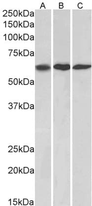 IHC-plus™ MMP14 Antibody (aa152-163)