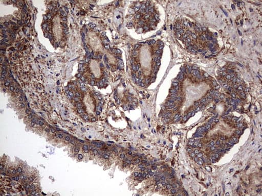 IL1RN Antibody (clone OTI2B1)