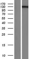 USP28 Protein (Over-Expression Lysate Myc-DDK (Flag))