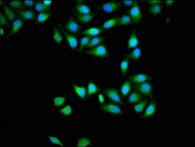 Polyclonal Rabbit anti-Human APOBEC3D Antibody (IHC)