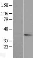 TGDS Protein (Over-Expression Lysate Myc-DDK (Flag))