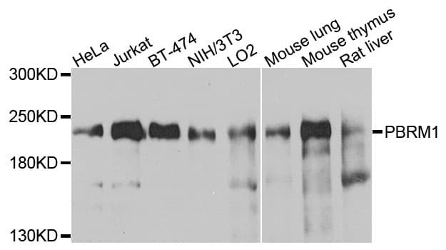 PBRM1 / BAF180 / PB1 Antibody