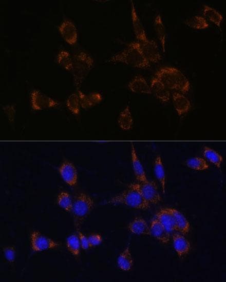 PRF1 / Perforin Antibody