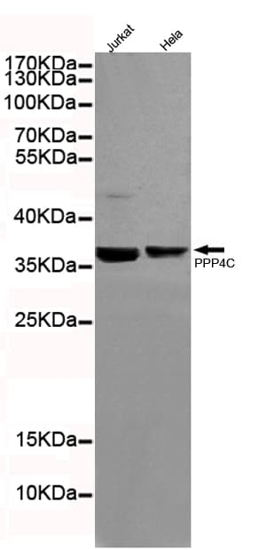 PPP4C Antibody