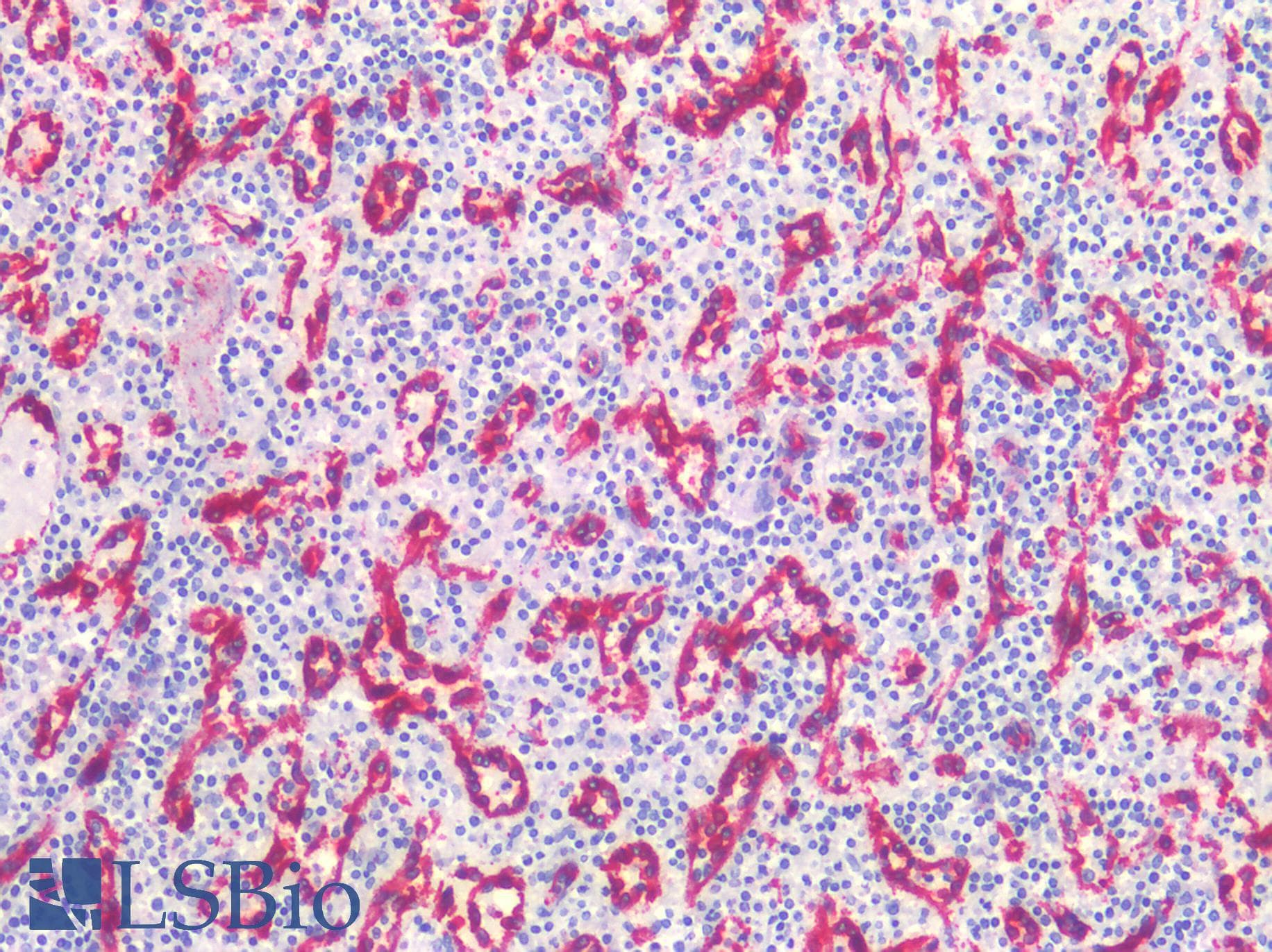 PathPlus™ CAV1 / Caveolin 1 Antibody (N-Terminus)