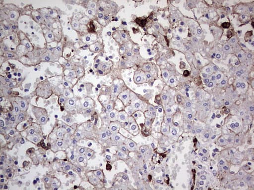 TACC2 Antibody (aa727-1026, clone OTI3C4)