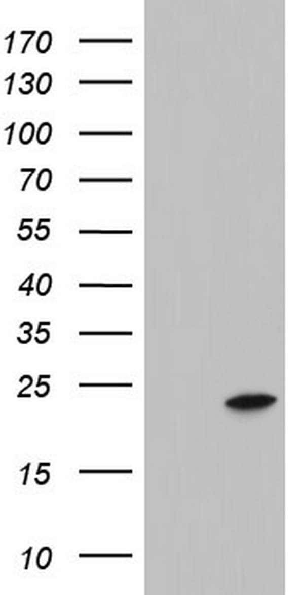 ITGB1BP1 / ICAP1 Antibody (clone OTI6A12, Carrier-free)
