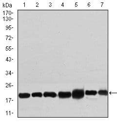 Monoclonal Mouse anti-Human RPL18A Antibody (clone 6G6G10, Amino Acid: 50-176, IHC, IF, WB)