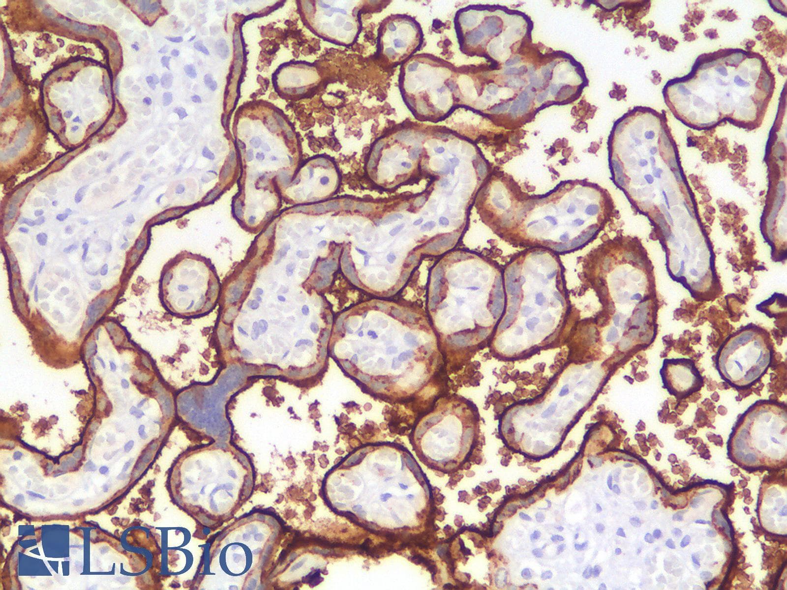 PathPlus™ PLAP / Alkaline Phosphatase Antibody (clone ALPP/2899R)