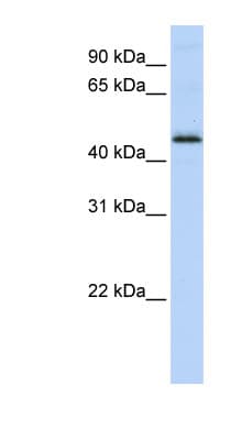 DEK Antibody (C-Terminus)