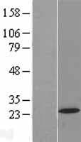 AP5S1 / C20orf29 Protein (Over-Expression Lysate Myc-DDK (Flag))
