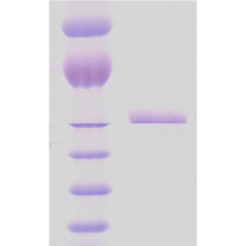 Mycobacterium bovis BCG GroEL / Hsp65 Protein (Recombinant)