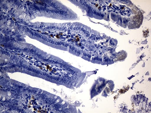 CD74 / CLIP Antibody (clone UMAB231, Carrier-free)