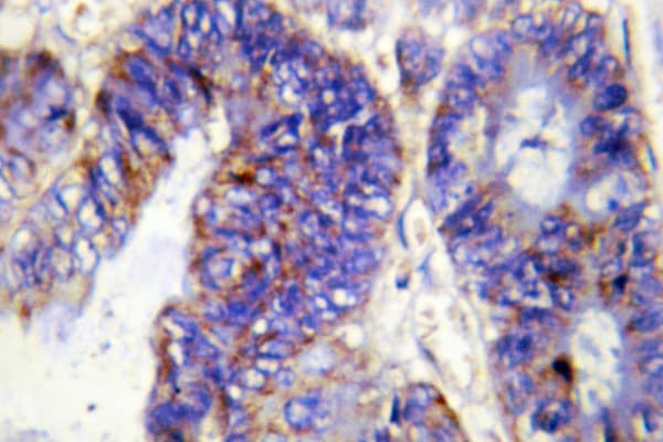 COL4A2 / Collagen IV Alpha2 Antibody (Pro175)